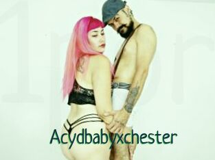 Acydbabyxchester